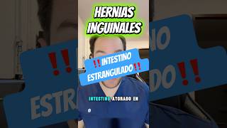 ‼️HERNIA ESTRANGULADA‼️ perdió el intestino! #shorts #viralshort
