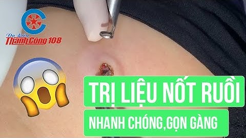 Tẩy nốt ruồi ở viện 108 giá bao nhiêu năm 2024