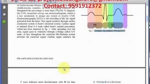Design And Implementation of 3-Lead ECG Machine For Rural Medification