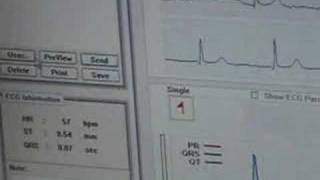 Electrocardiógrafo de bolsillo