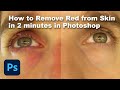 How to Remove Red from Skin in Photoshop in less than 2 minutes!