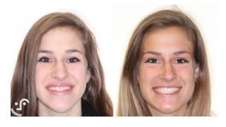 Barnett Orthondontics; Changing Smiles, Changing Lives