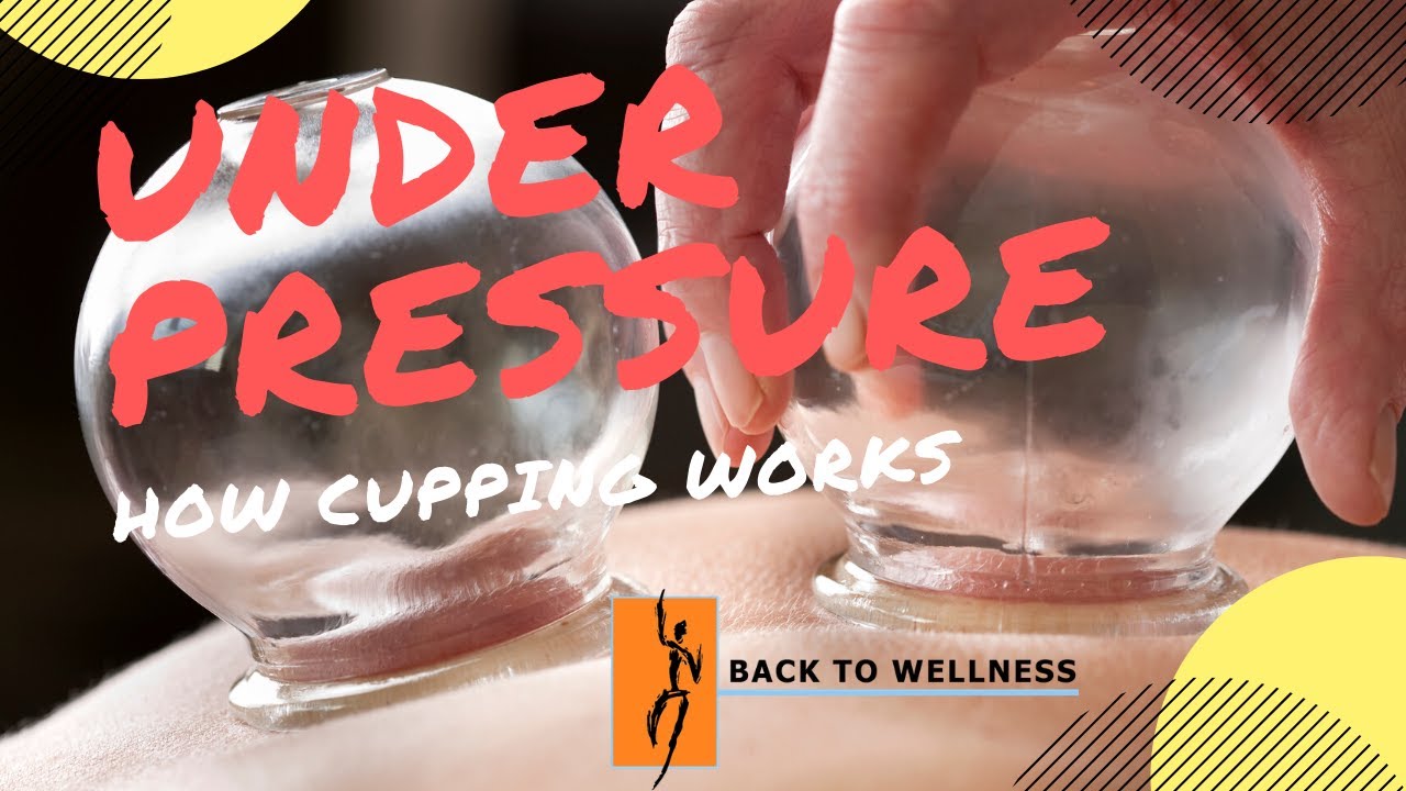 How Cupping Works