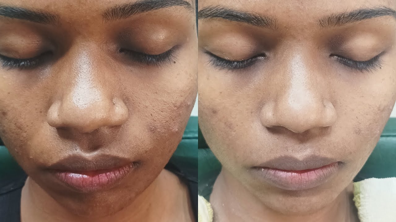 face pack Kaise lagaenface pack lagane ka Sahi tarikaNisha beauty