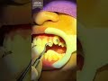🦷🎧 ไปติดเหล็กจัดฟัน Damon กัน!Putting on braces never sounded this relaxing 🎶