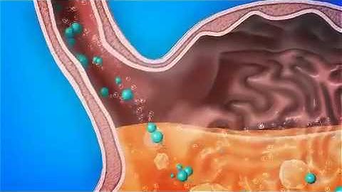 Thuốc ức chế bơm proton PPIs