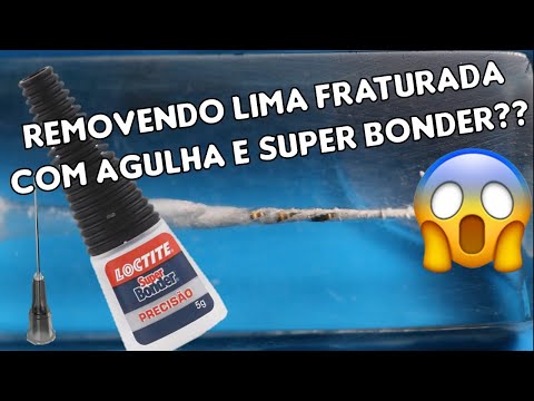 Vídeo: Você pode retirar um canal radicular?