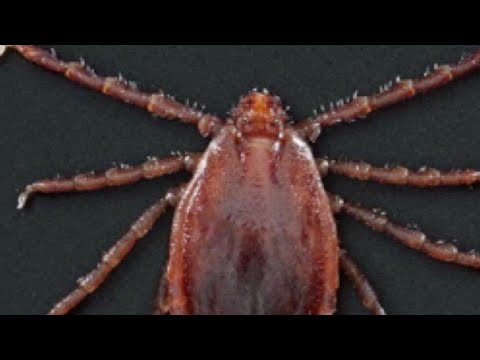 Doctors warn of tick-borne illnesses as summer nears