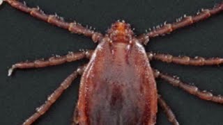 Doctors warn of tick-borne illnesses as summer nears