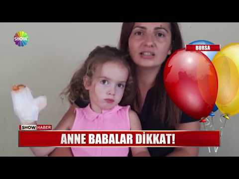 Uçan balon 3,5 yaşındaki Mira'yı yaktı