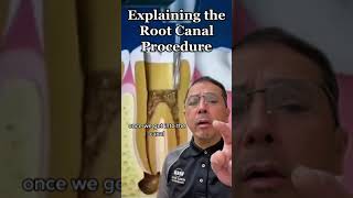 What Happens During a Root Canal Procedure? Dentist EXPLAINS | View Mobile Dental