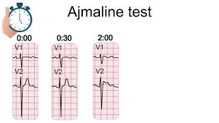 Ajmaline Test & Brugada Syndrome