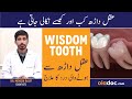 Wisdom Tooth Pain - Aqal Darh Ke Dard Ka Ilaj - Wisdom Teeth Removal - Aqal Darh Nikalne Ka Tarika