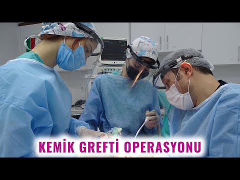 Kemik Grefti Operasyonu | Prof. Dr. Mustafa Tek