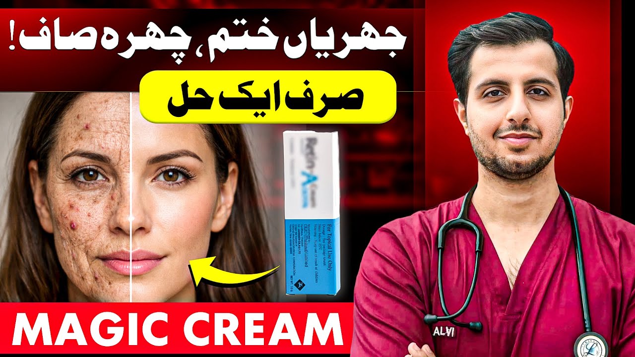 This One Ingredient Fixes Acne, Wrinkles & Dark Spots | Retinoids