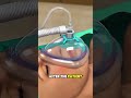 What Happens During Brain Surgery #3dmedicalanimation #craniotomy #brainsurgery #neurosurgery #3d