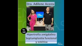 Hipertrofia amigdalina, septumplastía funcional y estética.