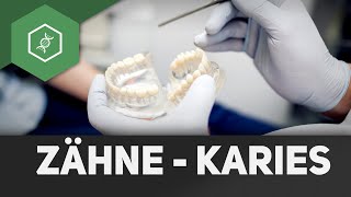 Zähne - Entstehung von Karies