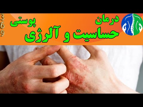 تصویری: نحوه رهایی از شپش بدن: 7 مرحله (همراه با تصاویر)