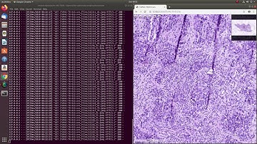 Deep Zoom for Whole Slide Images (WSI) with Python OpenSlide
