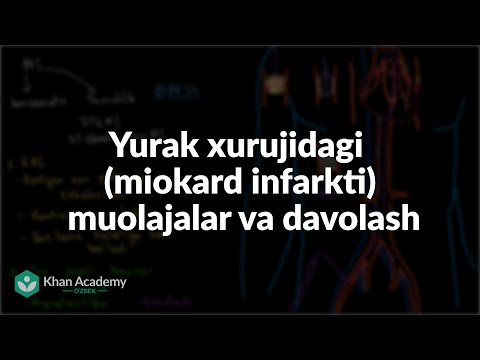 Video: Katta yoshdagi yurak shovqinini qanday davolash mumkin: 9 qadam (rasmlar bilan)