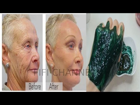 Arabic beauty secret to appearing 20 years younger, anti-aging anti-wrinkle treatment, botox