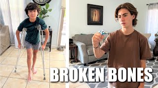 OUR KIDS BROKEN + FRACTURED + SPRAINED BONES | Broken or Fractured Foot and Badly Sprained Finger