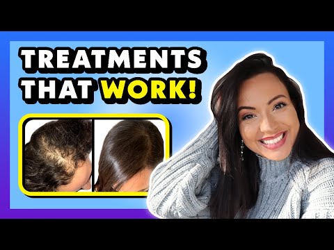 TREATMENTS THAT WORK FOR HAIR LOSS (Hair Loss Treatments For Women Backed By Science) ?