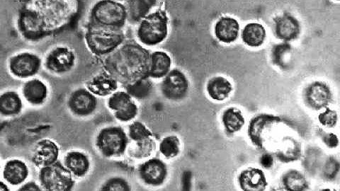 Inflammation process