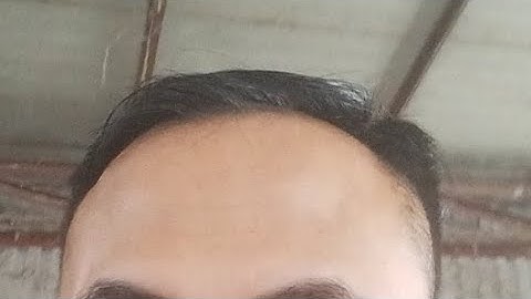 kho tời tự hãm. tời quay tay 1200 LBS. tời nâng rạp cưới