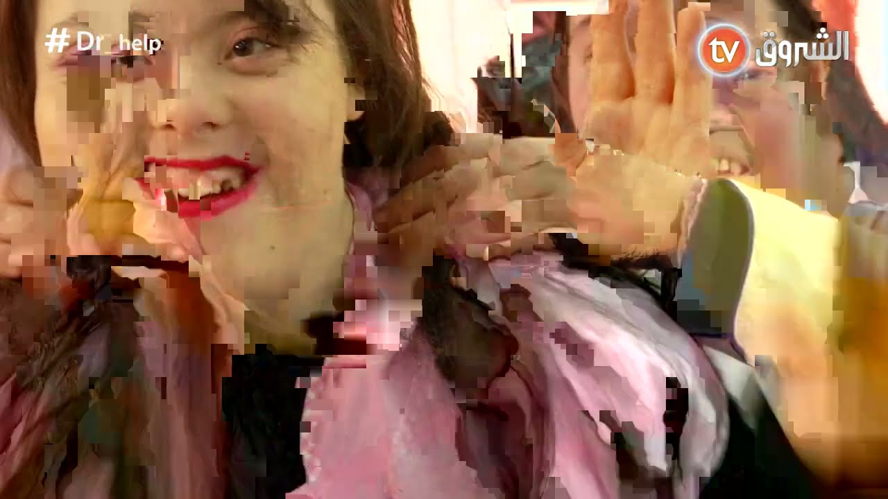 ماذا تعرف عن الأطفال المصابين بمتلازمة داون وعن طريقة التعامل معهم ؟