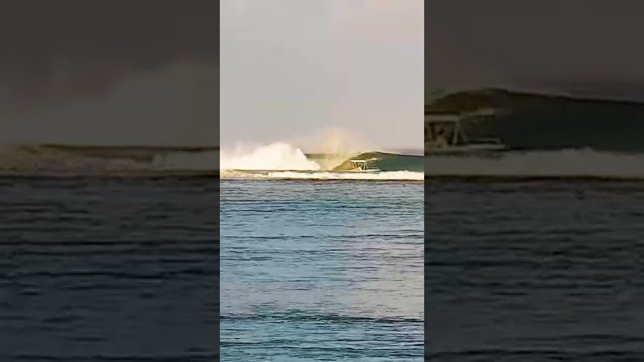 Clips
