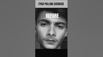 ZYGO PULLING EXERCISE TUTORIAL VIDEO #looksmaxxing #facefitness #faceexercise