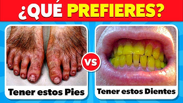 ¿QUÉ PREFIERES? ¡Las 100 DECISIONES MÁS DIFÍCILES! 🤔❓✅