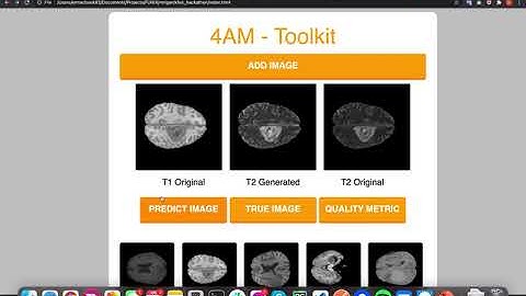 Brain MRI GAN Demo