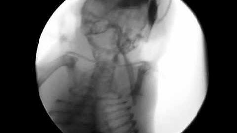 X-ray of Mouse Swallowing