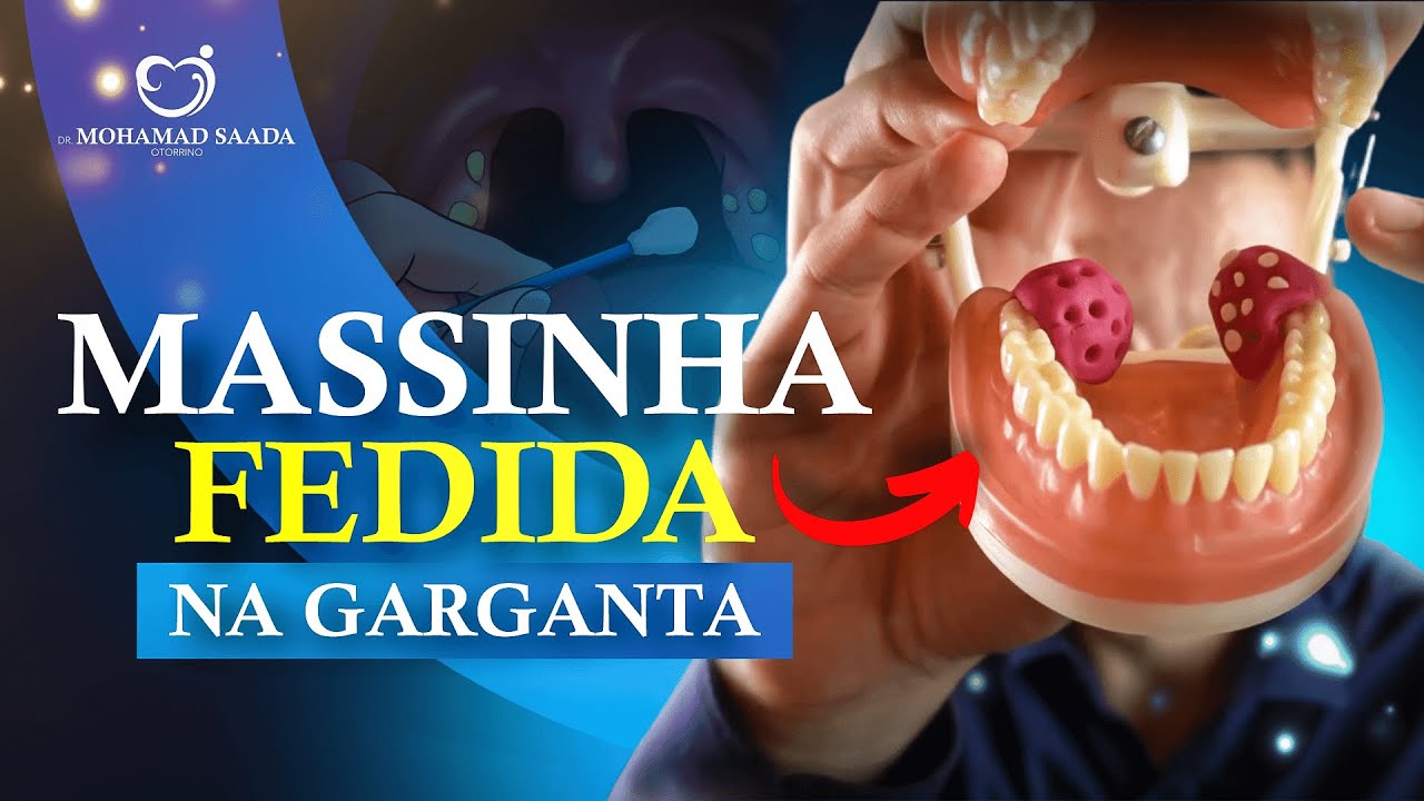 Massinha Fedida na Garganta