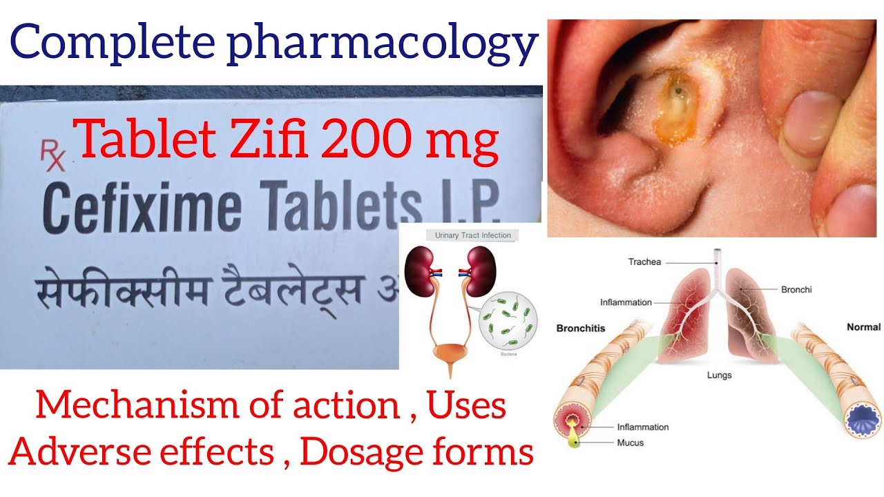 Cefixime tablet IP 200 mg used for / Mechanism of action , Adverse