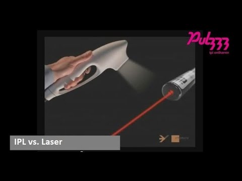Wat is het verschil tussen Ipl en laser ontharen?