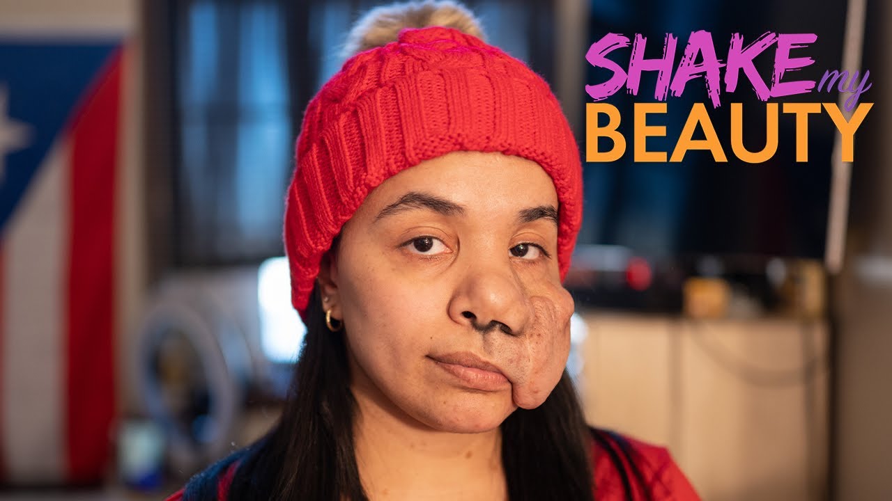 I'll Never Get Surgery - I Embrace My Face | SHAKE MY BEAUTY