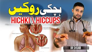 Hichki Kaise Band Kare Hiccups Treatment In Urduhindi