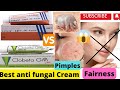 Lobate gm cream |Clobeta gm cream ke fayde |uses in hindi |kaise lagaye |क्लोबेटा जीएम क्रीम