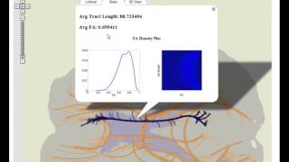 Exploring Brain Connectivity with Two-dimensional Neural Maps--Google Maps Interface