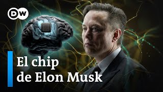 Telepathy: el implante cerebral de Musk