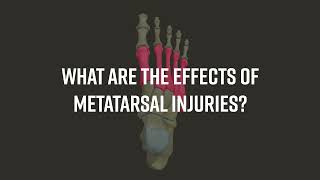 The Importance Of Metatarsal Foot Protection Lyreco Intersafe