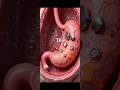 majestic super acid in you stomach #facts #viral #reels #nature ##shorts #human #youtubeshorts #fun