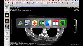 STR Cardiothoracic Case Webinar 2/1/2018