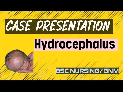 nursing case study on hydrocephalus