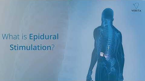 How does epidural stimulation treatment for spinal cord injury work?