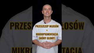 Przeszczep włosów + Mikropigmentacja skóry głowy! Sprawdź! ##mikropigmentacjaskórygłowy